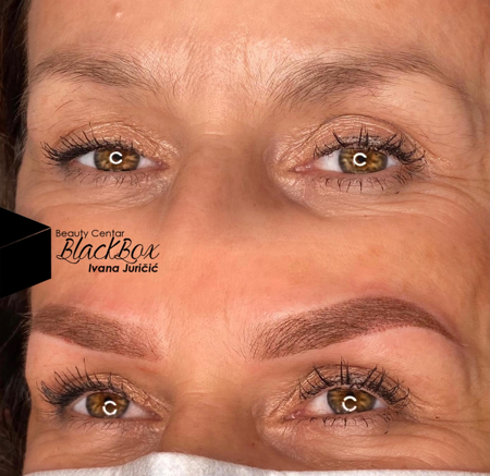 Imagen de POWDER BROWS online course